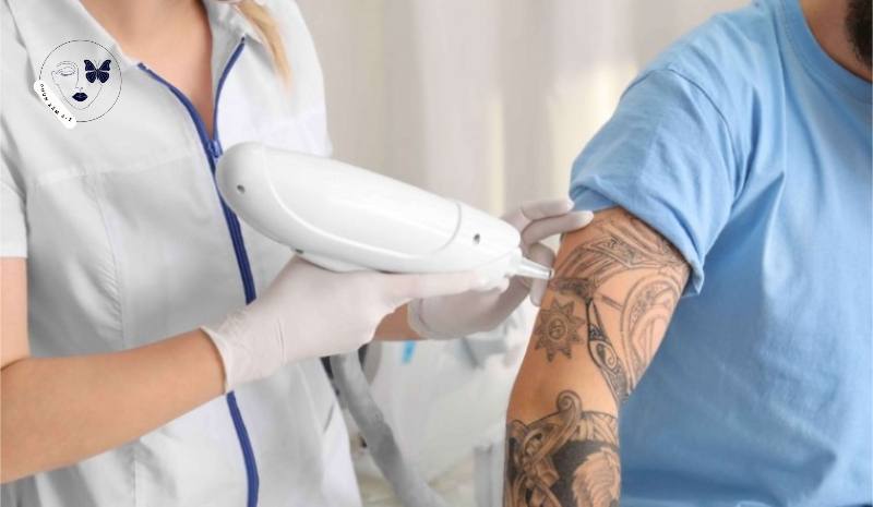 Xóa hình xăm vĩnh viễn